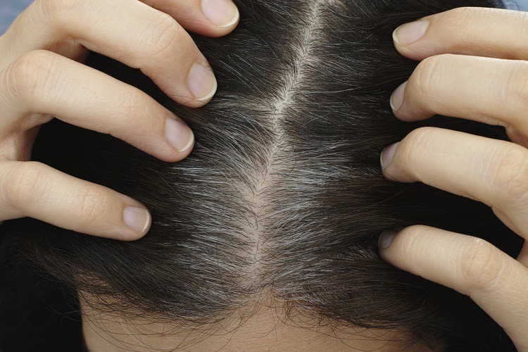 De ce stresul provoacă încărunţirea părului. Explicația neașteptată a cercetătorilor