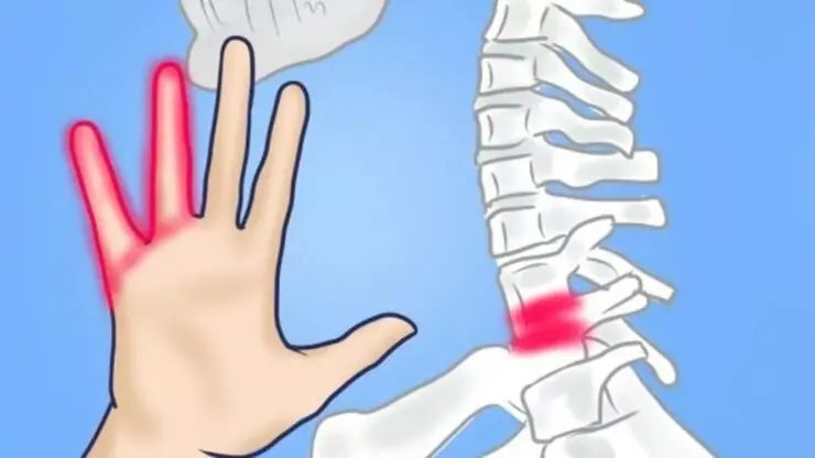 Cinci cauze posibile ale amorțirii mâinilor – de ce ar trebui să mergeți la medic