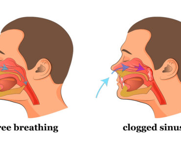 Ai nasul infundat? Acest truc simplu te va ajuta sa-ti eliberezi nasul in cateva secunde!