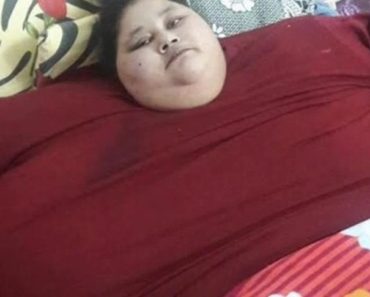 Cea mai grea femeie din lume a pierdut din greutate de la 500 kg la 172 kg în doar câteva luni