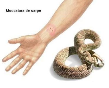 Ce faci dacă te muşcă un şarpe. 10 sfaturi care îţi pot salva viaţa
