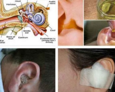 Cel mai bun remediu pentru durerile de urechi