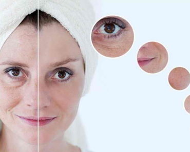 Rețetă de mască cu amidon de porumb cu efect botox pentru femeile de peste 30 ani